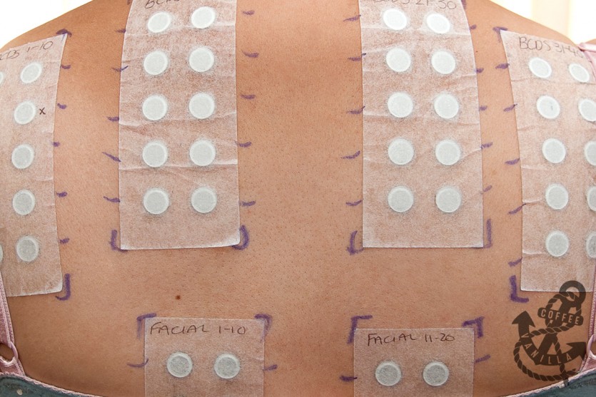 patch test for allergic reaction to cosmetics UK formaldehyde allergy